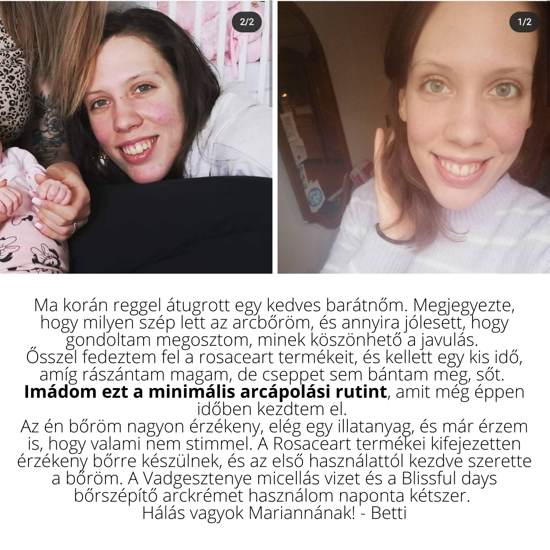 Kézápolás felsőfokon